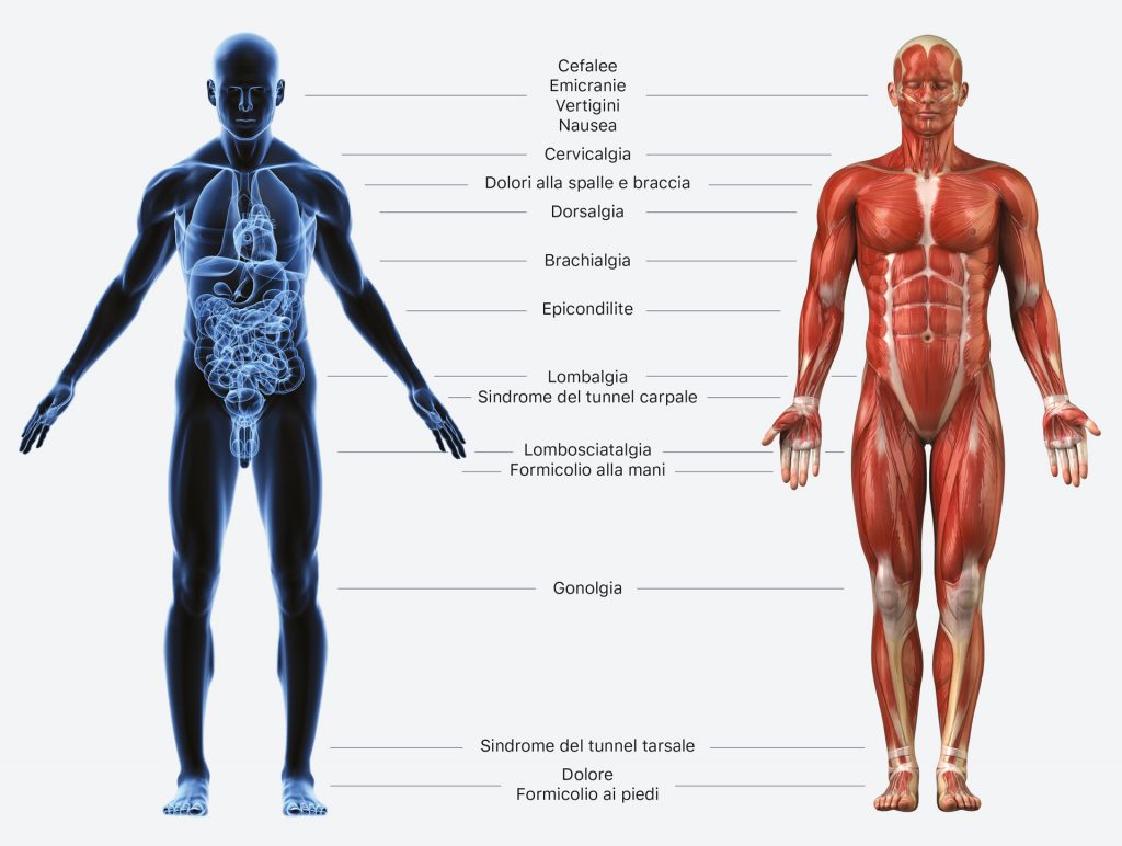 chiropratica infografica