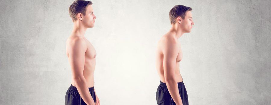 curare la postura chiropratica